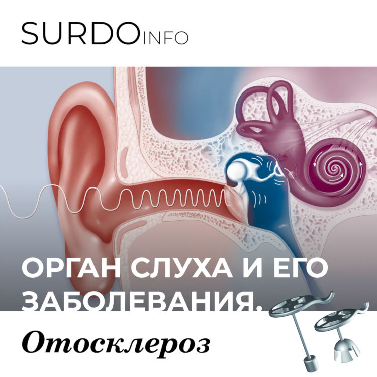 Орган слуха и его заболевания